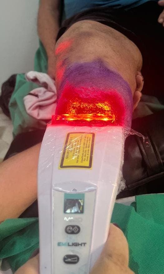 Laserterapia - foto 3