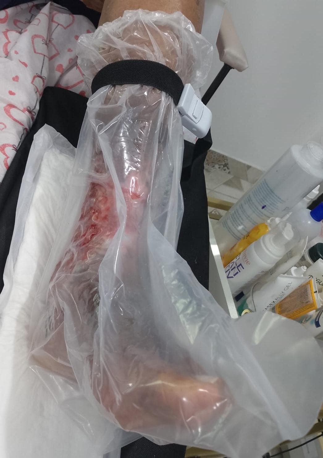 Ozonioterapia - foto 3