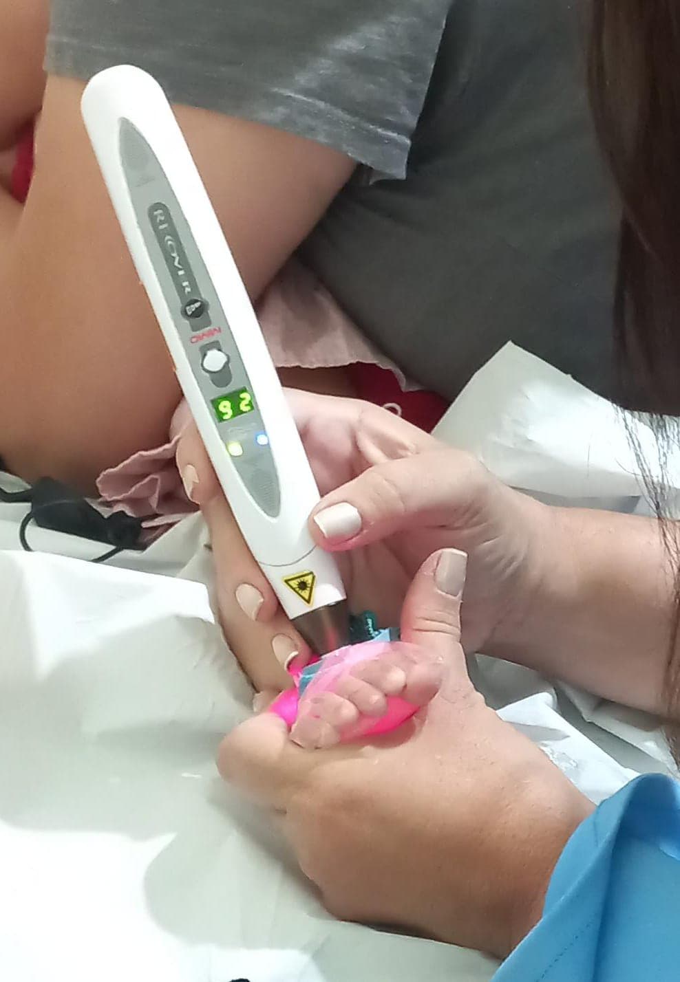 Laser na Pediatria - foto 3