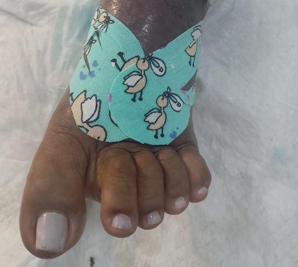 Taping Terapêutico - foto 1