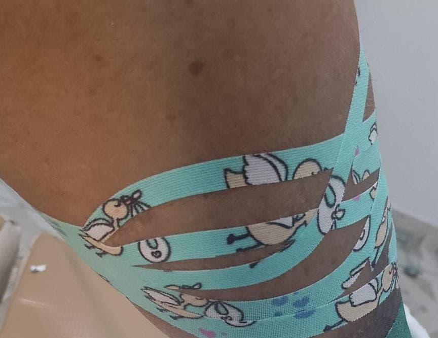 Taping Terapêutico - foto 4